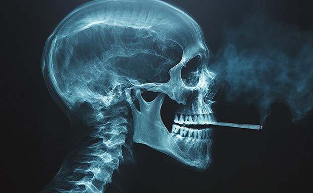 Риск рака легких от каннабиса Долгосрочные проблемы для легких от курения каннабиса