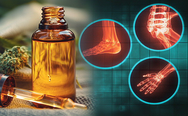 КБД при артрите: руководство для пациентов Каннабидиол: безопасное решение для боли?