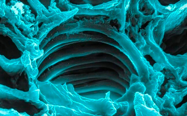 Лигнитовая спираль под увеличением Спиральная клетка под микроскопом