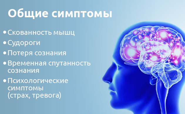 Общие симптомы эпилепсии Симптомы эпилепсии