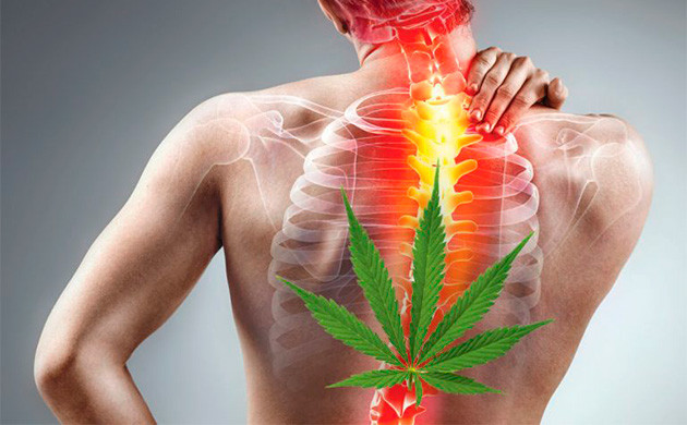 Способность конопли снимать воспаление Снятие воспаления с помощью каннабиса