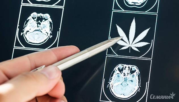 КБД для эпилепсии Эпилепсия и КБД